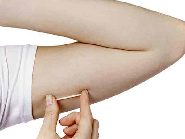 Removing the contraceptive implant